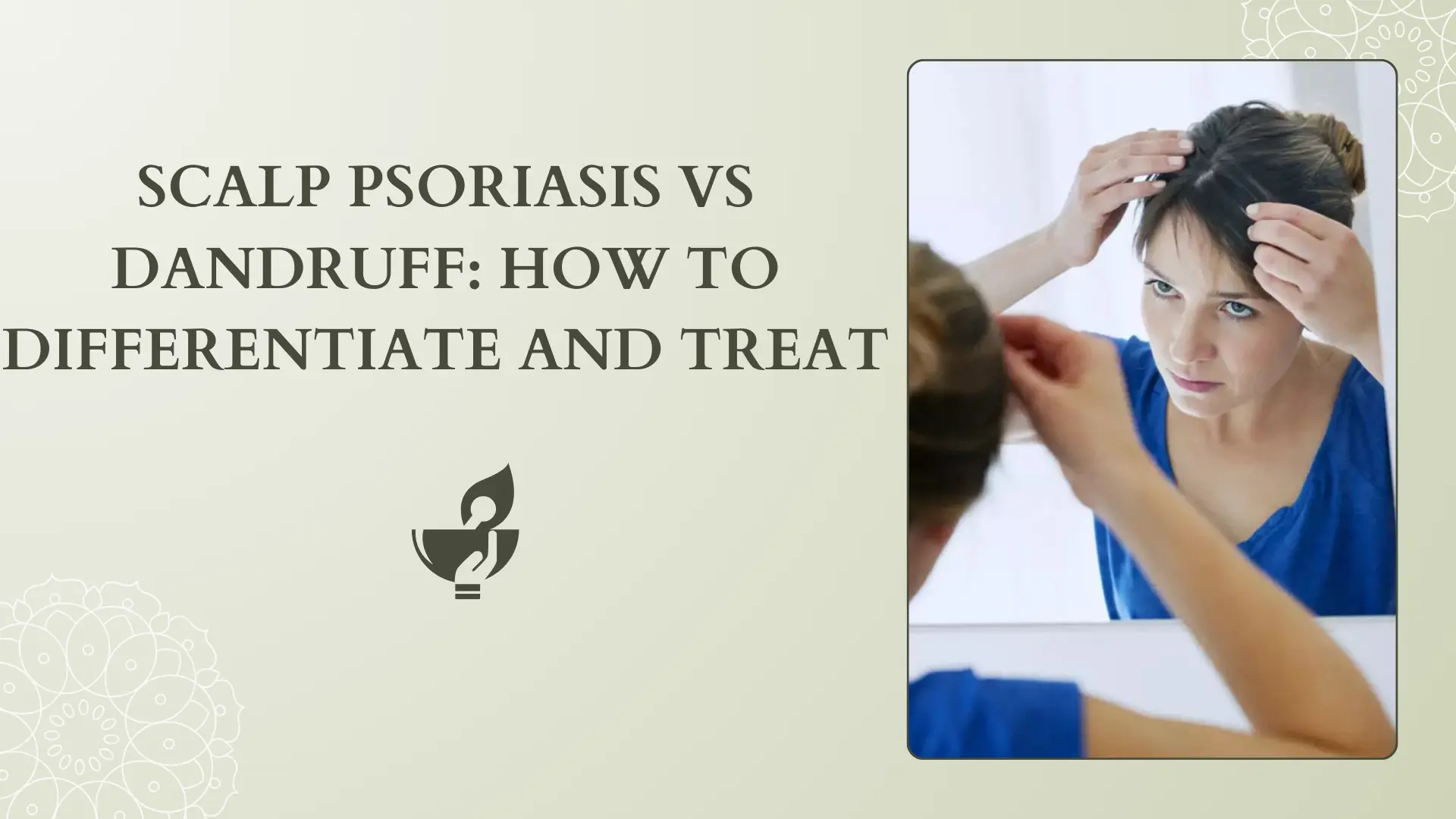 How to Differentiate Scalp Psoriasis and Dandruff