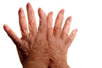 arthritis treatment in bangalore Card image cap