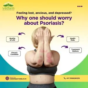 Ayurvedic treatment for skin eczema