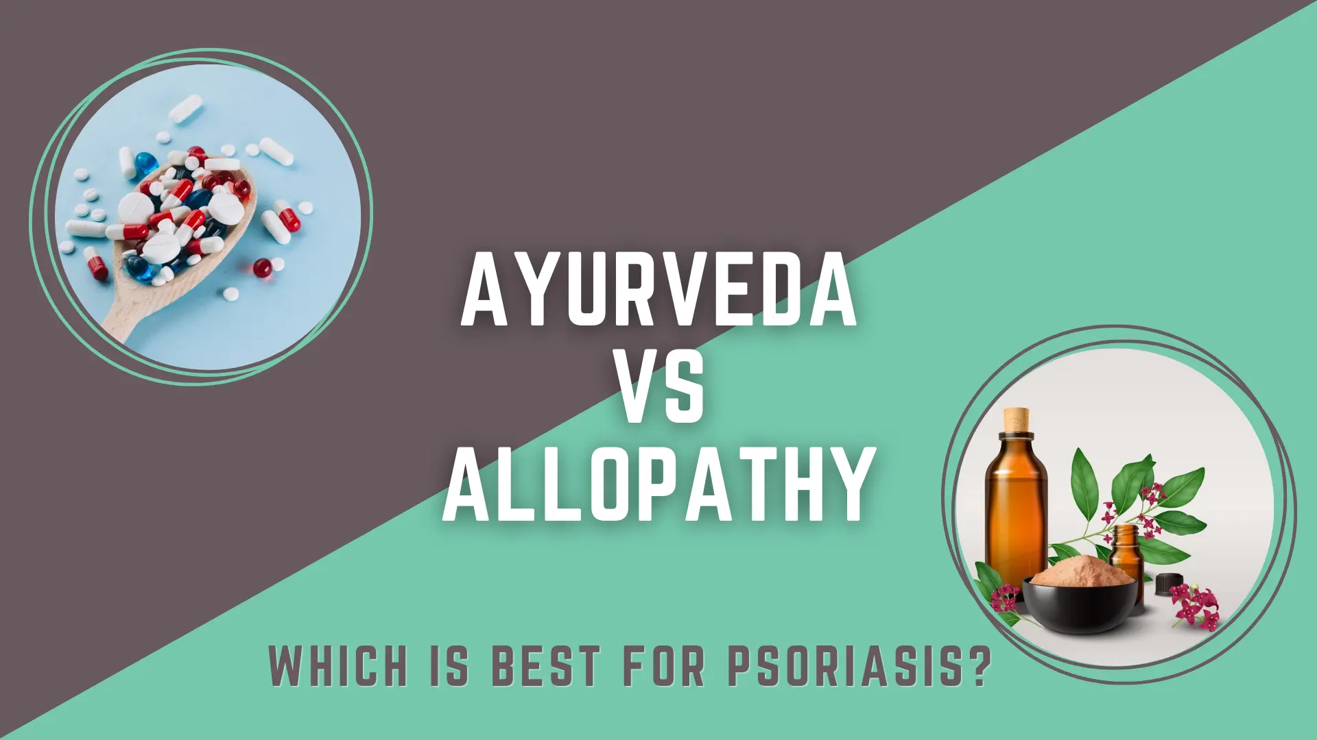 Ayurveda vs Allopathy Which is Best for Psoriasis? - veda