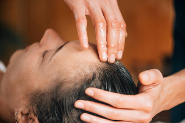 Ayurvedic Treatment for Scalp Psoriasis