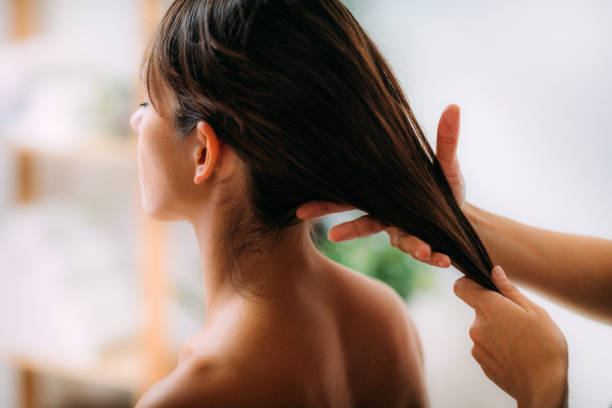Vedam Ayurveda approach for scalp psoriasis