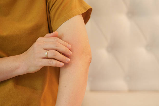 Ayurvedic Treatment for Plaque Psoriasis